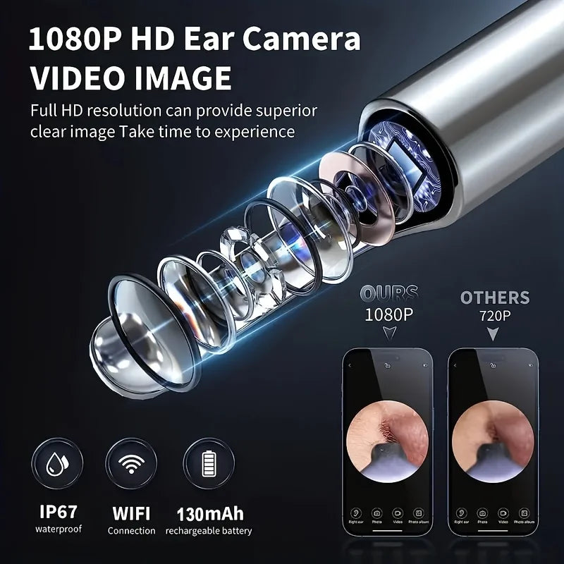 Nettoyeur d'oreille visuel intelligent 1296P, bâtons d'oreille, Otoscope, chargement USB C, Endoscope, outil d'élimination de la cire, Mini caméra